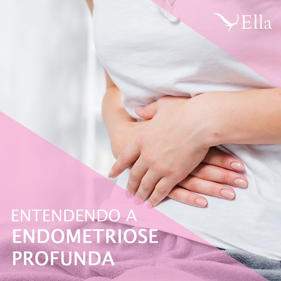 You are currently viewing Entendendo a endometriose profunda