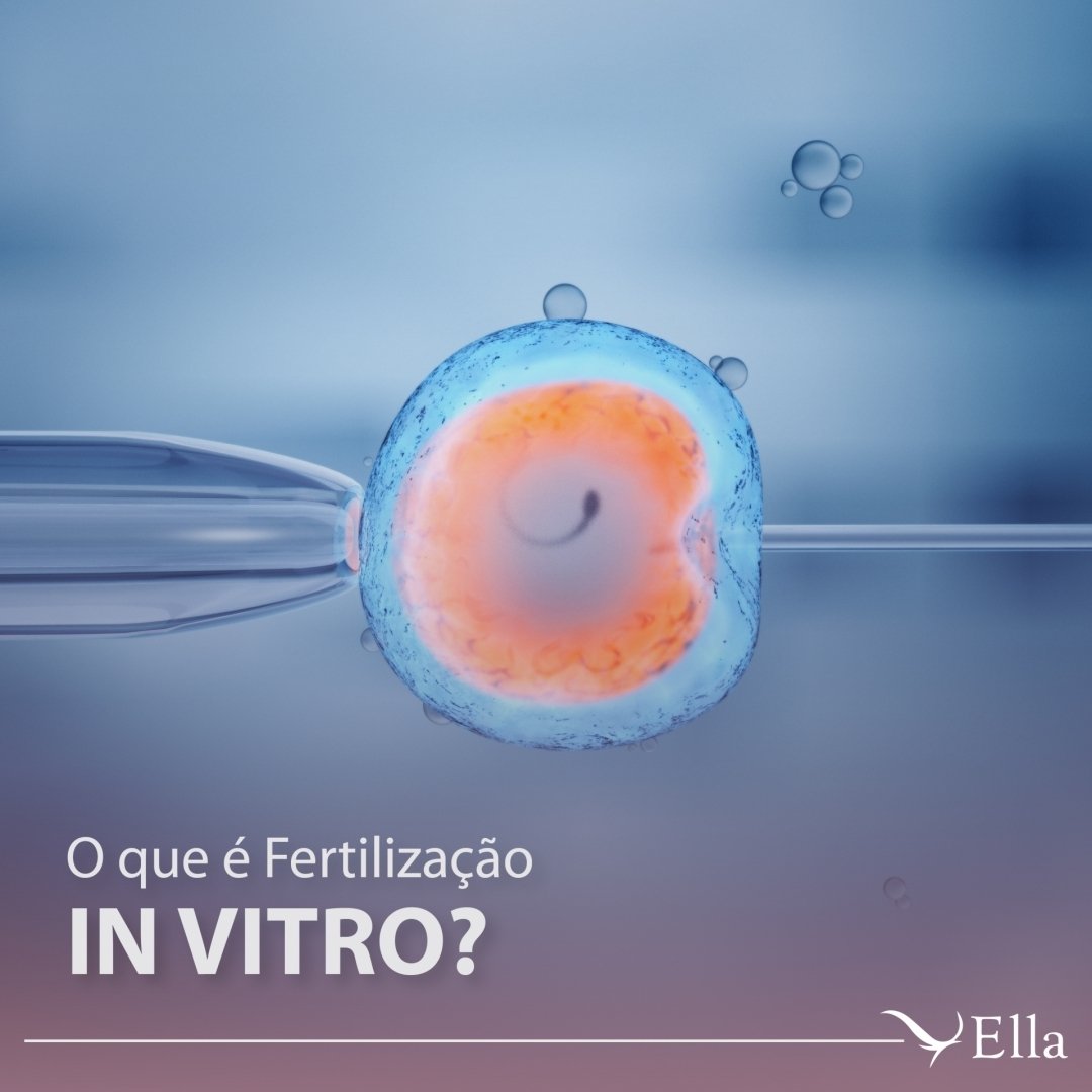 You are currently viewing O que é  Fertilização In Vitro